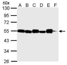 Anti-alpha Tubulin antibody [GT114] used in Western Blot (WB). GTX628802